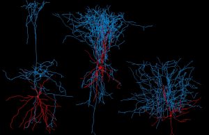 Nuevos indicios de que el Parkinson podría originarse en el intestino