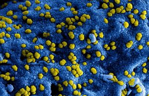 Los pacientes recuperados mantendrían anticuerpos durante 6 meses, según estudio chino