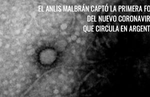 El Malbrán obtuvo la primera imagen de la cepa del coronavirus que circula en la Argentina Imagen de la cepa local