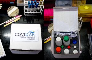 Argentina financiará el desarrollo de nuevos kits para detectar portadores de coronavirus