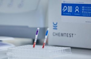 Los tests de diagnóstico rápido Neokit-Covid19 y ELA-CHEMSTRIP fueron distribuidos en hospitales públicos