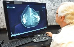 Desmintiendo noticias falsas en las redes: las mamografías no causan cáncer de tiroides Mamografías regulares para prevenir el cáncer de mama.