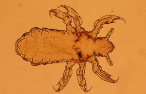 En la pandemia la incidencia de pediculosis cayó al 44% Piojos y liendres. Un mal que está en la cabeza de muchos.
