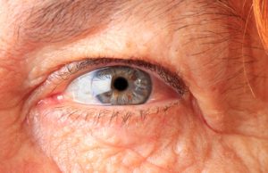 8 tips para manter la vista saludable Una patología ocular que ahora tiene un tratamiento más efectivo.