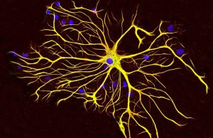 Hipótesis médica: ¿es el virus de Epstein-Barr el responsable de la Esclerosis Múltiple? “Estos hallazgos brindan datos convincentes que señalan al VEB como el desencadenante del desarrollo de la EM