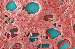 Legionella: encontraron al culpable del brote infeccioso en Tucumán Una bacteria responsable del brote.
