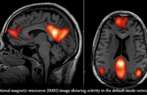 ¿Qué dicen los estudios científicos sobre la mente de un magnicida? Imágenes cerebrales via RMN