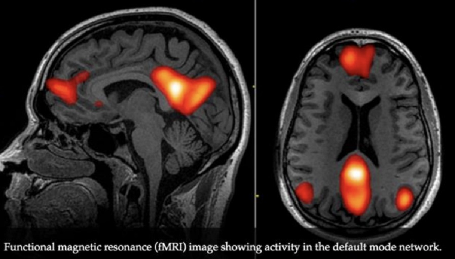 Imágenes cerebrales via RMN