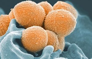 Preocupa el aumento de casos de faringitis en Argentina Streptococcus pyogenes, una bacteria Gram-positiva que es la usual responsable bacteriana de mayor frecuencia asociada a las faringitis agudas.