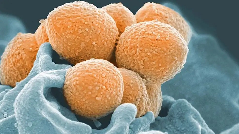 Streptococcus pyogenes, una bacteria Gram-positiva que es la usual responsable bacteriana de mayor frecuencia asociada a las faringitis agudas.