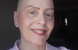 Convocan a una caminata para concientizar sobre alopecia, una rara enfermedad autoinmune DEPRESION. Esta enfermedad afecta mucho a la calidad de vida. | GZA: Entrevistada