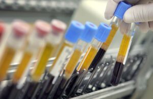 Un medicamento que funciona como vacuna contra el Sida elegido como “avance médico del 2024” AVANCE. Un nuevo tipo de molécula que sirve para controlar mejor a los virus como el VIH.